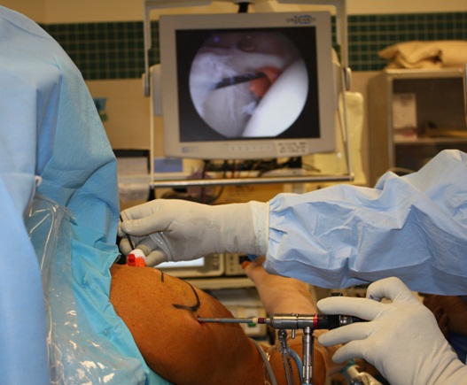 Surgeons performing Shoulder Arthroscopy